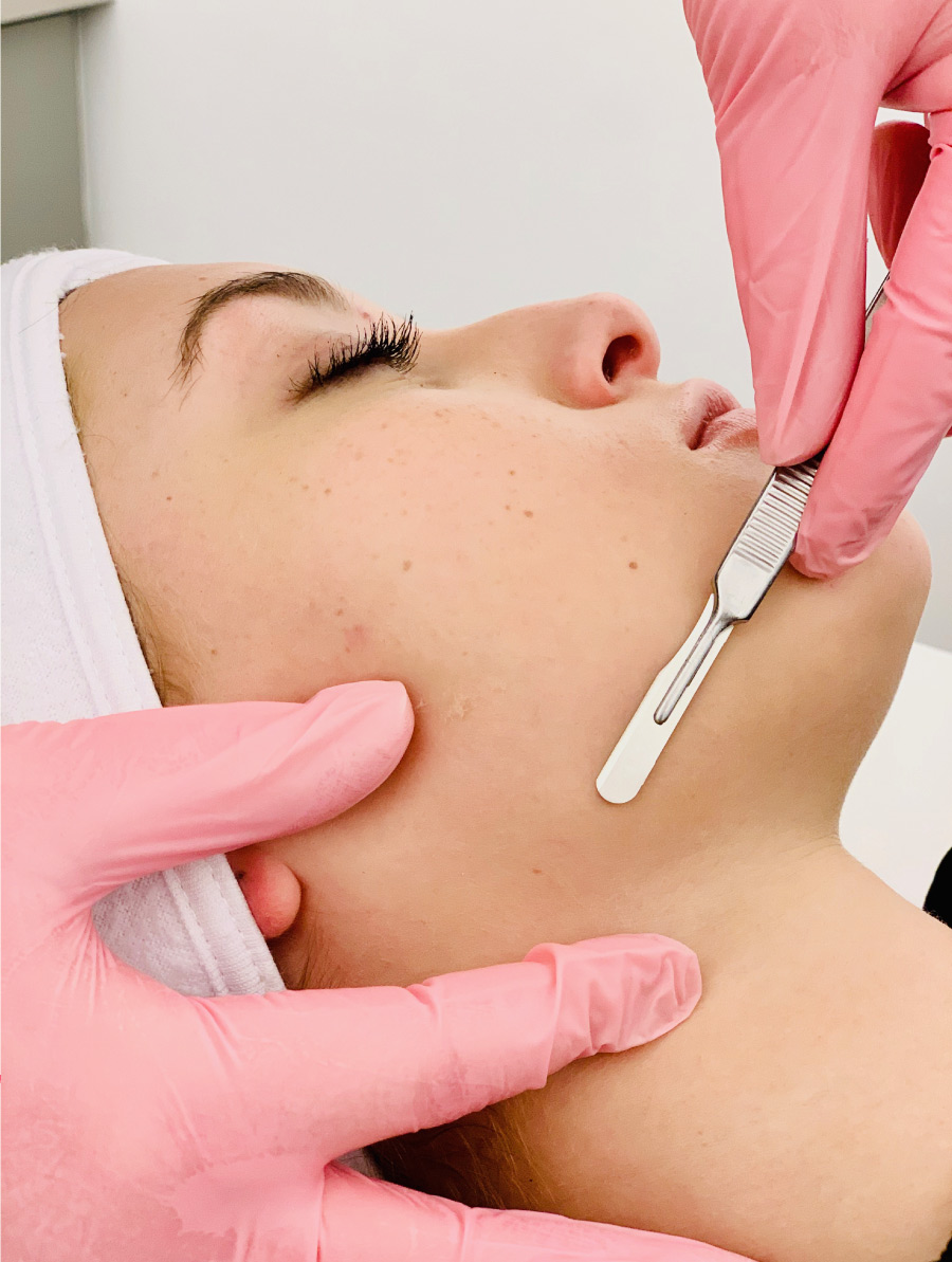 Dermaplaning